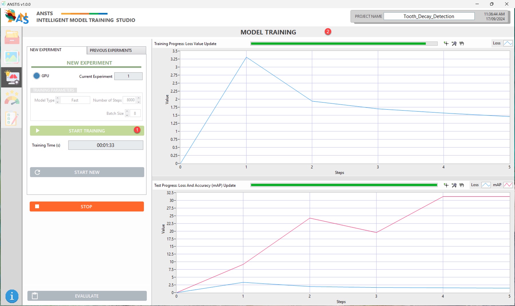 ANSTS model training — live loss and accuracy charts for a tooth-decay detection experiment